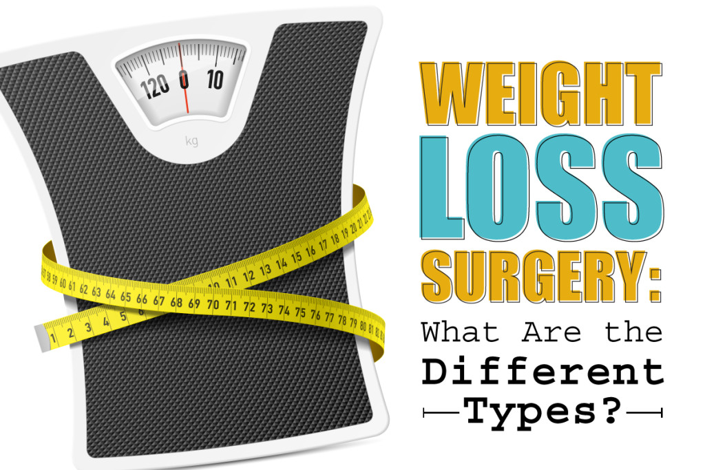 Types Of Weight Loss Surgery Dr Steven Fass 