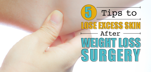 5 Tips To Shed Excess Skin After Weight Loss Surgery Dr Steven Fass 