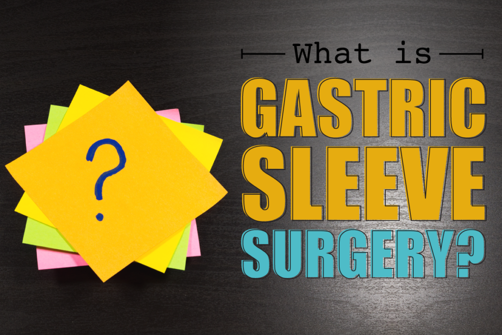 What Is Gastric Sleeve Surgery Dr Steven Fass 